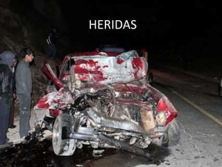 HERIDAS
 