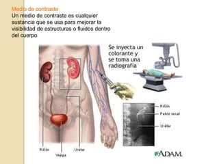 Medio de contraste
Un medio de contraste es cualquier
sustancia que se usa para mejorar la
visibilidad de estructuras o fluidos dentro
del cuerpo
 