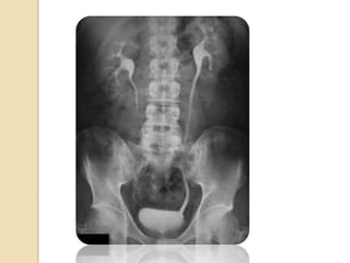  patrones funcionales