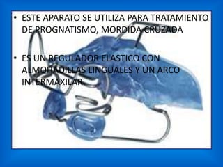 • ESTE APARATO SE UTILIZA PARA TRATAMIENTO
DE PROGNATISMO, MORDIDA CRUZADA
• ES UN REGULADOR ELASTICO CON
ALMOHADILLAS LINGUALES Y UN ARCO
INTERMAXILAR.

 