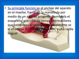 • Su principla funcion es el anclaje del aparato
en el maxilar, frenando la mandíbula por
medio de un arco de progenie. Remodela el
esqueleto, gracias a las ramas intermaxilares
que componen el aparato. Habitualmente se
le añade un tornillo de expansión, y una rejilla
lingual.

 