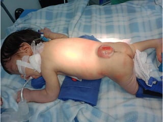 DIAPOSITIVAS CUADRO CLINICO_MMC.pdf