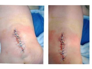 DIAPOSITIVAS CUADRO CLINICO_MMC.pdf