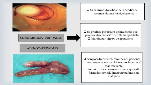 El dolor de la ingle hasta los riñones a la derecha