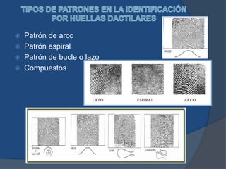  Patrón de arco
 Patrón espiral
 Patrón de bucle o lazo
 Compuestos
 