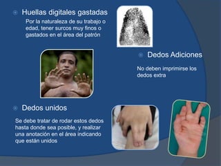  Huellas digitales gastadas
 Dedos Adiciones
 Dedos unidos
Por la naturaleza de su trabajo o
edad, tener surcos muy finos o
gastados en el área del patrón
No deben imprimirse los
dedos extra
Se debe tratar de rodar estos dedos
hasta donde sea posible, y realizar
una anotación en el área indicando
que están unidos
 