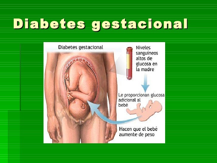 Diabetes Gestacional Diabetes Gestacional