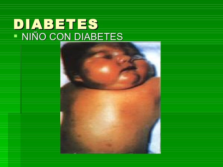 Diabetes Gestacional Diabetes Gestacional