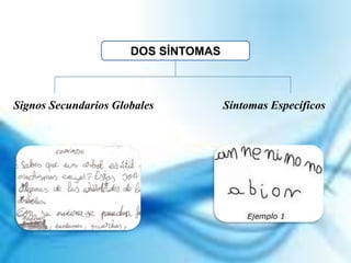 Signos Secundarios Globales Síntomas Específicos
DOS SÍNTOMAS
 