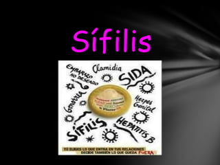Sífilis
 