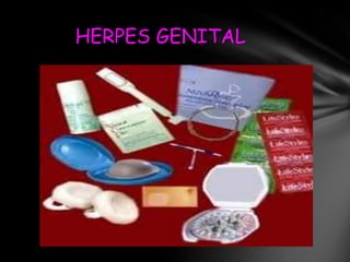 HERPES GENITAL
 