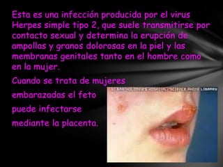 Esta es una infección producida por el virus
Herpes simple tipo 2, que suele transmitirse por
contacto sexual y determina la erupción de
ampollas y granos dolorosas en la piel y las
membranas genitales tanto en el hombre como
en la mujer.
Cuando se trata de mujeres
embarazadas el feto
puede infectarse
mediante la placenta.
 