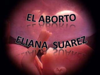 Diapositivas del aborto