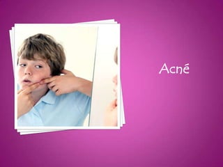 Acné
 