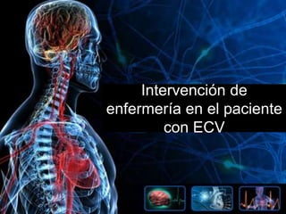 Intervención de
enfermería en el paciente
con ECV

 