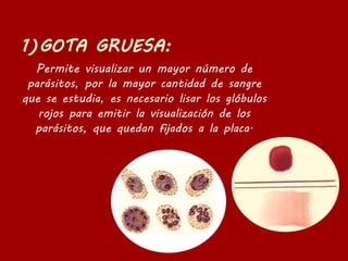 Permite visualizar un mayor número de
parásitos, por la mayor cantidad de sangre
que se estudia, es necesario lisar los glóbulos
rojos para emitir la visualización de los
parásitos, que quedan fijados a la placa.
 