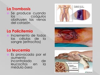 Son los defensores del cuerpo y para ello segregan fermentos coagulantes y antitoxinas.Glóbulos Rojos:Llamados hematíes o eritrocitos