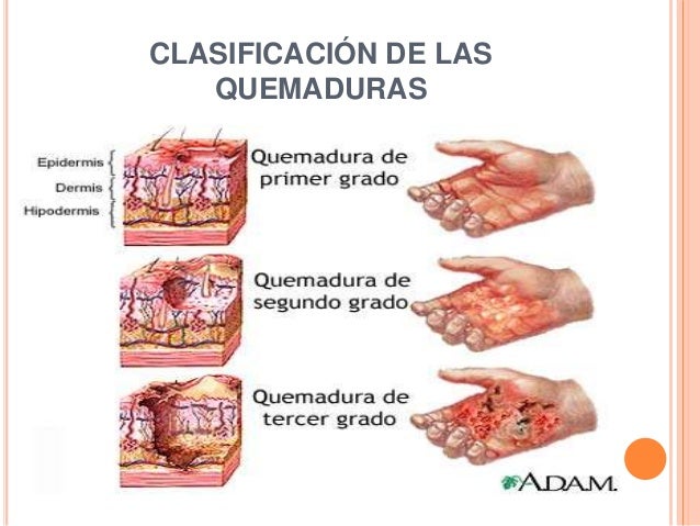 Como blanquear la cutis