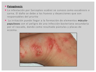  Patogénesis
 La infestación por Sarcoptes scabiei se conoce como escabiosis o
sarna. El daño se debe a los huevos y deyecciones que son
responsables del prurito
 La irritación puede llegar a la formación de elementos máculo-
papulosos con el peligro de una infección bacteriana secundaria
por el rascado, dando como resultado pústulas y placas de
eczema.
 