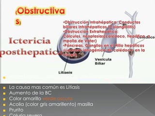 Por obstáculo u oclusión de la vías extrahepáticas e
intrahepáticas
La causa mas común es Litiasis
Aumento de la BC
Color amarillo verde oscuro
Acolia (color gris amarillento) masilla
Prurito
 