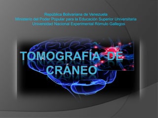 República Bolivariana de Venezuela
Ministerio del Poder Popular para la Educación Superior Universitaria
Universidad Nacional Experimental Rómulo Gallegos

 