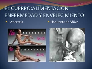 EL CUERPO:ALIMENTACION
ENFERMEDAD Y ENVEJECIMIENTO
 - Anorexia    Habitante de África
 