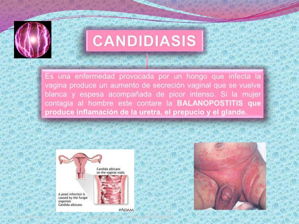 Diapositivas enfermedades venereas Diapositivas enfermedades venereas
