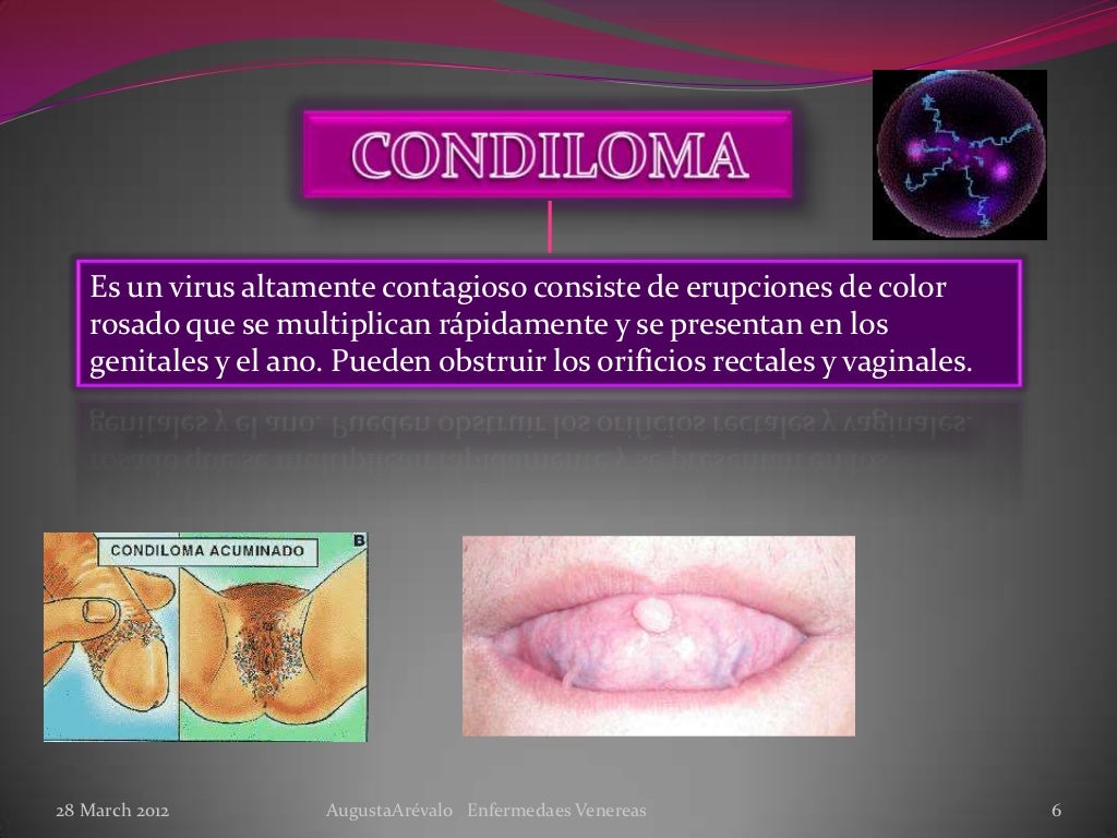 Diapositivas enfermedades venereas Diapositivas enfermedades venereas