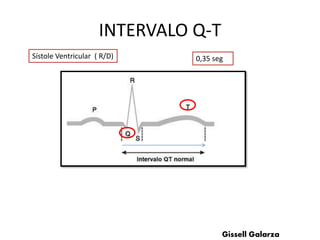 INTERVALO Q-T
Sístole Ventricular ( R/D) 0,35 seg
Gissell Galarza
 