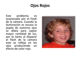 Ojos Rojos Este problema es ocasionado por el Flash de la cámara. Cuando la iluminación es escasa la pupila de nuestros ojos se dilata para captar mayor cantidad de luz, por lo tanto al disparar el flash de la cámara este se refleja en los ojos produciendo un efecto de color rojo. 