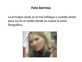 Foto borrosa La principal cauda es el mal enfoque o cuando existe poca luz en el medio donde se realiza la toma fotográfica.  
