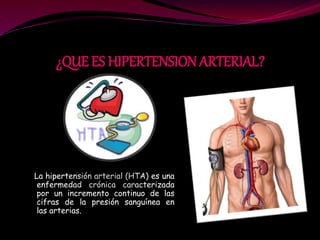 ¿QUE ES HIPERTENSION ARTERIAL?
La hipertensión arterial (HTA) es una
enfermedad crónica caracterizada
por un incremento continuo de las
cifras de la presión sanguínea en
las arterias.