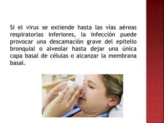 Si el virus se extiende hasta las vías aéreas
respiratorias inferiores, la infección puede
provocar una descamación grave del epitelio
bronquial o alveolar hasta dejar una única
capa basal de células o alcanzar la membrana
basal.
 