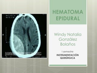 HEMATOMA
                                                                                                      EPIDURAL

                                                                                                     Windy Natalia
                                                                                                       González
                                                                                                        Bolaños
http://www.google.com.co/imgres?q=epidural+hematoma+craneal&um=1&hl=es&sa=X&tbm=isch&tbnid=H89
gvxLv3Gyw8M:&imgrefurl=http://drjcnunezm.com/category/trauma-craneoencefalico/&docid=TEU8JpErF-
                                                                                                          I semestre
                                                                                                      INSTRUMENTACIÓN
j3oM&w=343&h=258&ei=IW9eTqGrE4qhtweKhvWlCw&zoom=1&iact=hc&vpx=724&vpy=160&dur=712&hovh=195&
hovw=259&tx=141&ty=133&page=5&tbnh=141&tbnw=196&start=54&ndsp=13&ved=1t:429,r:3,s:54&biw=1024&bih=
625



                                                                                                         QUIRÚRGICA
 