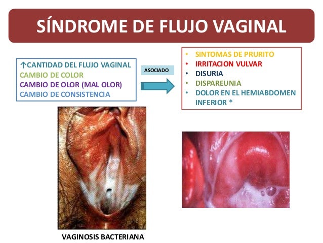 La crema más buena del hongo en los pies