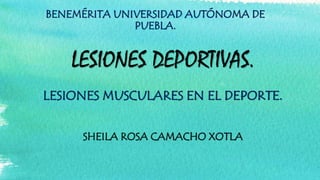 BENEMÉRITA UNIVERSIDAD AUTÓNOMA DE
PUEBLA.

LESIONES DEPORTIVAS.
LESIONES MUSCULARES EN EL DEPORTE.
SHEILA ROSA CAMACHO XOTLA

 