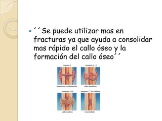  ´´Se puede utilizar mas en
fracturas ya que ayuda a consolidar
mas rápido el callo óseo y la
formación del callo óseo´´
 