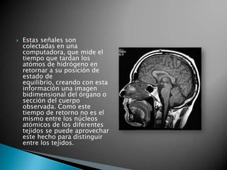    Estas señales son
    colectadas en una
    computadora, que mide el
    tiempo que tardan los
    atómos de hidrógeno en
    retornar a su posición de
    estado de
    equilibrio, creando con esta
    información una imagen
    bidimensional del órgano o
    sección del cuerpo
    observada. Como este
    tiempo de retorno no es el
    mismo entre los núcleos
    atómicos de los diferentes
    tejidos se puede aprovechar
    este hecho para distinguir
    entre los tejidos.
 