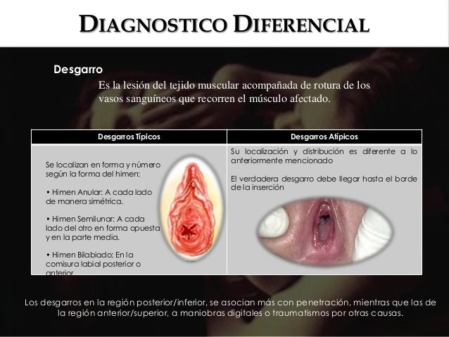 porn 100 sexo anal primeira vez porn 100 sexo anal primeira vez
