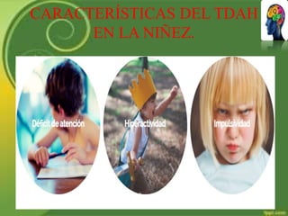 CARACTERÍSTICAS DEL TDAH
EN LA NIÑEZ.
 