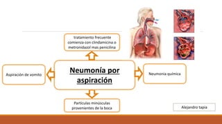diapositivas Neumonía.pptx
