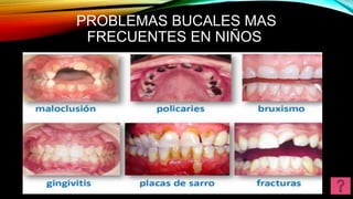 PROBLEMAS BUCALES MAS
FRECUENTES EN NIÑOS
 