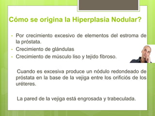 Cómo se origina la Hiperplasia Nodular?
• Por crecimiento excesivo de elementos del estroma de
la próstata.
• Crecimiento de glándulas
• Crecimiento de músculo liso y tejido fibroso.
Cuando es excesiva produce un nódulo redondeado de
próstata en la base de la vejiga entre los orificiós de los
uréteres.
La pared de la vejiga está engrosada y trabeculada.
 