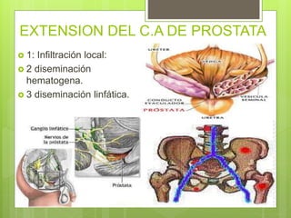 EXTENSION DEL C.A DE PROSTATA
 1: Infiltración local:
 2 diseminación
hematogena.
 3 diseminación linfática.
 