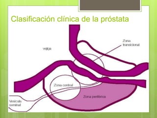 Clasificación clínica de la próstata
 