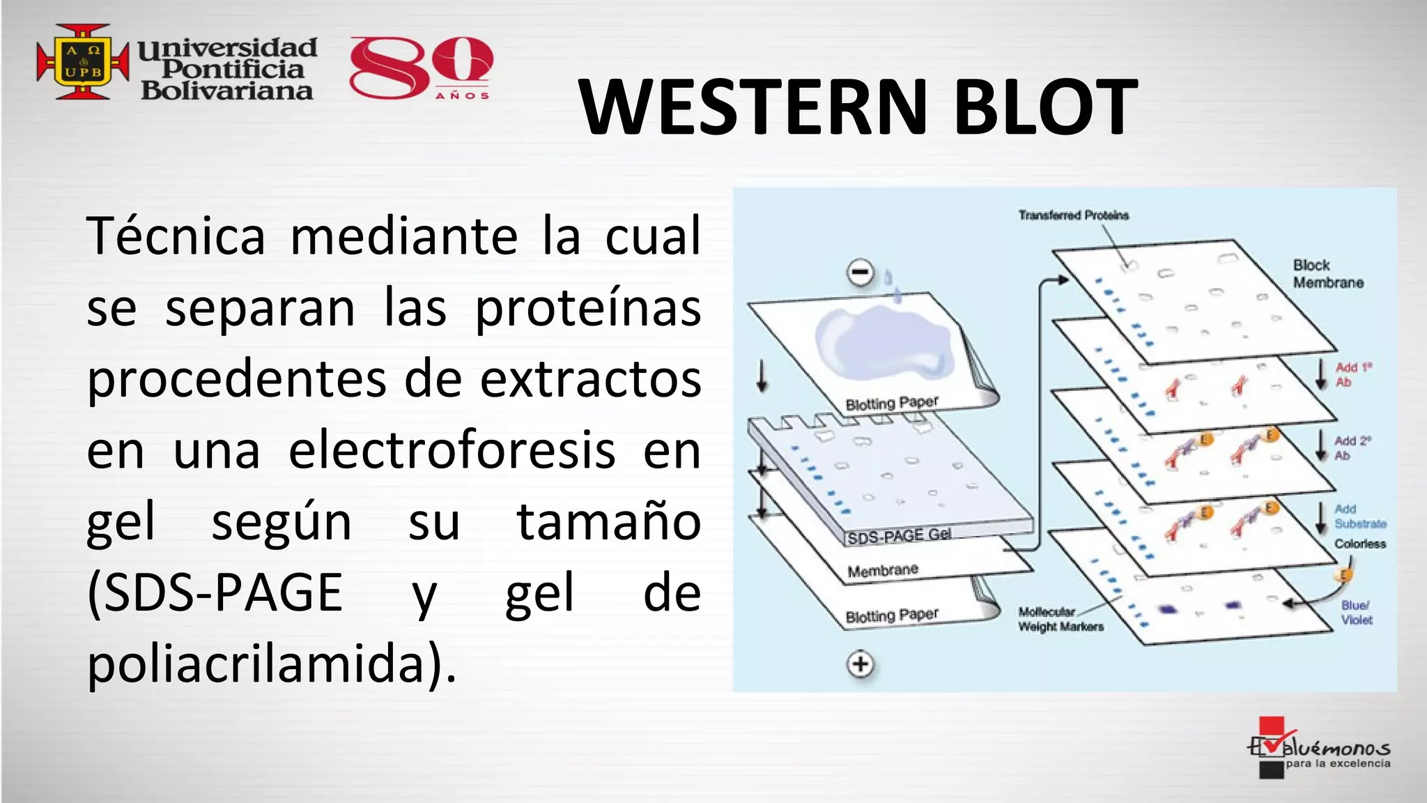 WESTERN BLOT
Técnica mediante la cual
se separan las proteínas
procedentes de extractos
en una electroforesis en
gel según su tamaño
(SDS-PAGE y gel de
poliacrilamida).
 