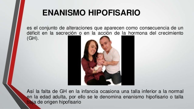 enanismo hipofisiario
