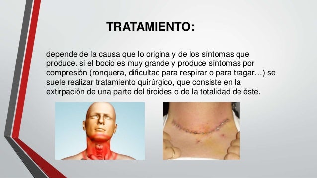 enfermedades del sistema endocrino y sus causas