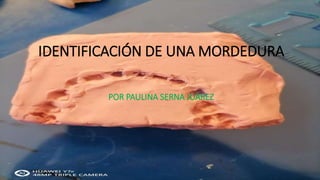 IDENTIFICACIÓN DE UNA MORDEDURA
POR PAULINA SERNA JUÁREZ
 