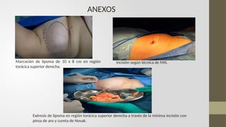 diapositivas técnica mis.pptx técnica de mínima incisión en lesiones de ...